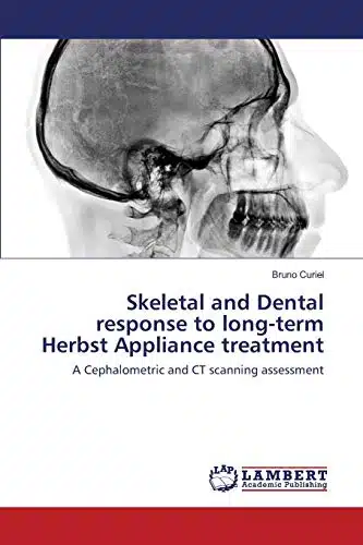 Skeletal and Dental response to long term Herbst Appliance treatment A Cephalometric and CT scanning assessment